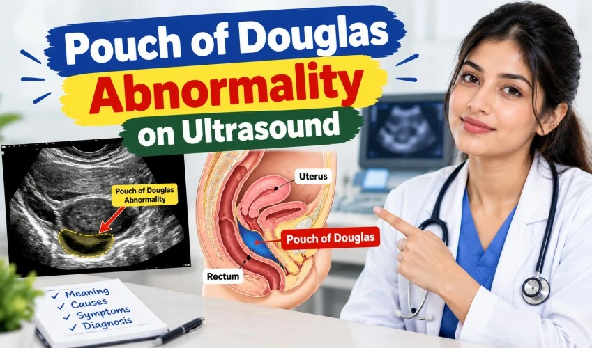 Pouch of Douglas Abnormality on Ultrasound